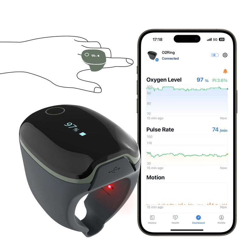 ViATOM O2ring Bluetooth Oximeter, Pulse Oximeter Fingertip for Continuous Monitoring at Night, Sleep Oximeter for Measuring SpO2 & Heart Rate (Premium Card)